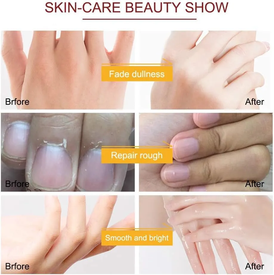 Hand Mask, 5 Pairs Hand Moisturizing Gloves Repairing Hand Mask for Extra Dry Skin Spa Masks, Exfoliating Hand Peeling Mask, Repair Rough Skin for Men & Women (C)